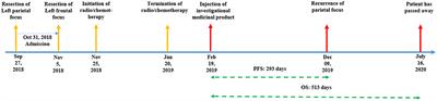 Case report: Stem cell-based suicide gene therapy mediated by the herpes simplex virus thymidine kinase gene reduces tumor progression in multifocal glioblastoma